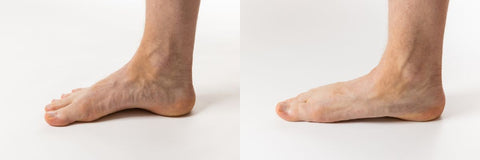 On the left is a healthily arched foot, on the right is a flat foot without an arch